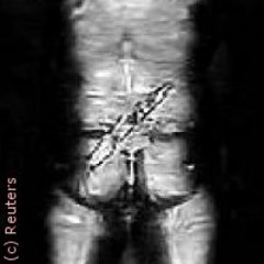 Un portique impudique à l'aéroport de Nice - Batiweb